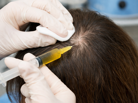 Can PRP Reverse Hair Thinning Naturally?