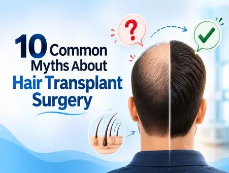 10 Common Myths About Hair Transplant Surgery